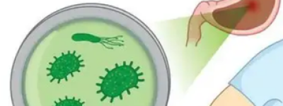 早期幽门螺旋杆菌感染有哪些症状