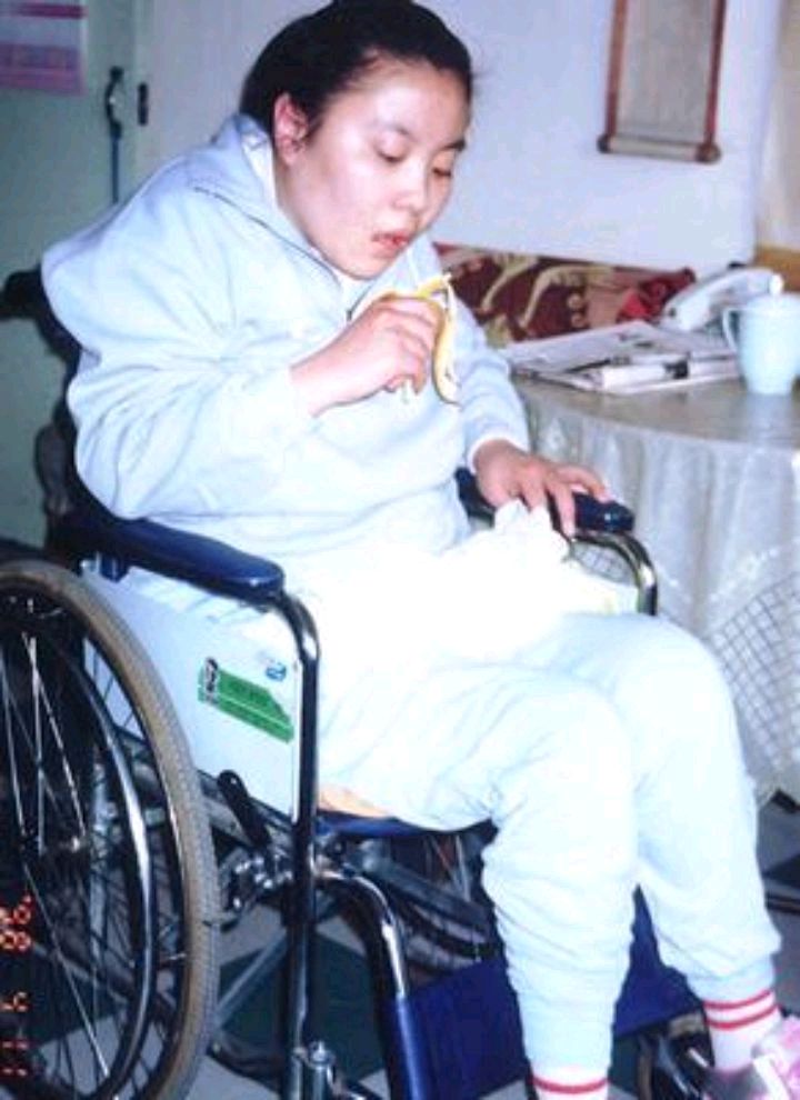 铊中毒_铊元素中毒_北大女孩中毒铊