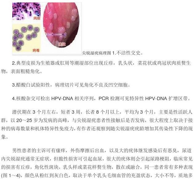 尖锐湿疣_尖锐湿疣_尖锐湿疣