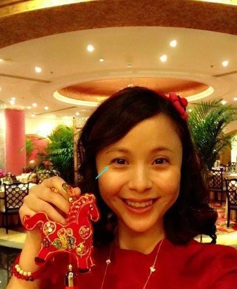 张檬整容记对比照_张檬当谁的小3_张檬