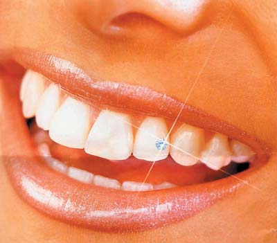 牙种植体什么牌子的好_牙种植过程_种植牙